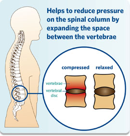 compressed disc diagram